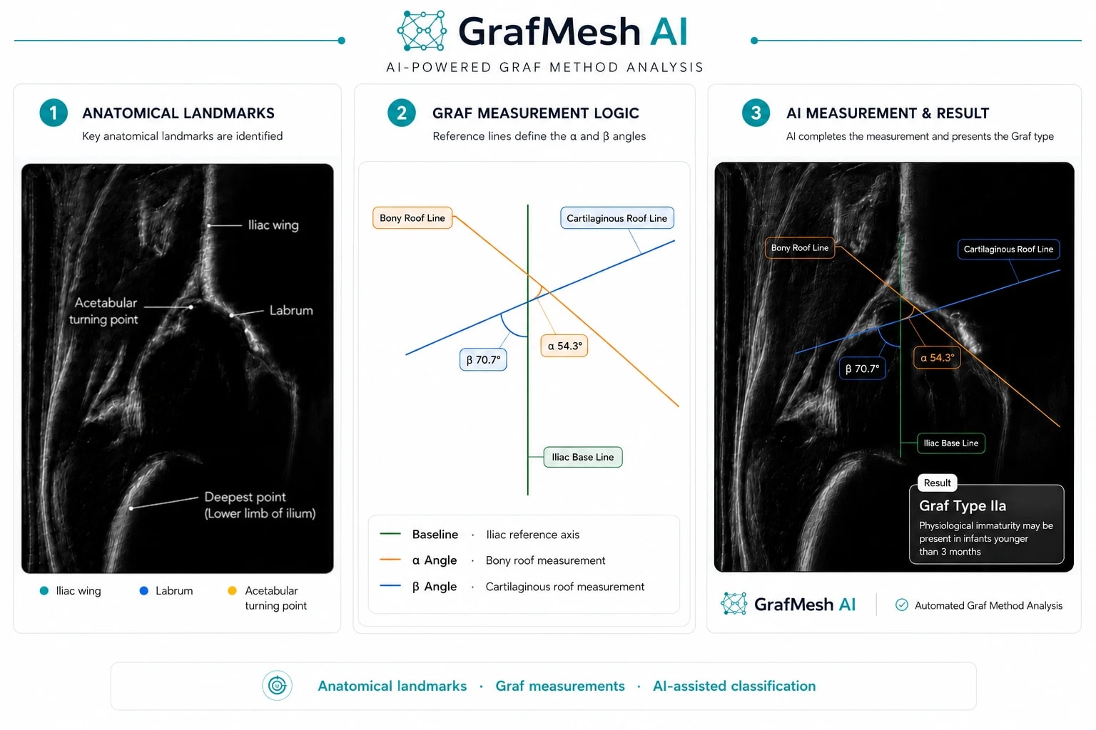 Graf yöntemi infografiği: anatomik referans noktaları, α ve β açı diyagramı ve GrafMesh AI otomatik ölçüm analizi