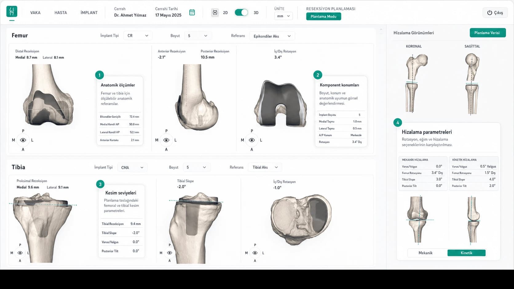 OrthoAlign AI interface